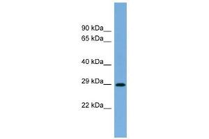 RAB40C antibody used at 1 ug/ml to detect target protein. (RAB40C 抗体  (N-Term))