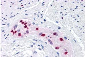 Human Colon, myenteric plexus: Formalin-Fixed, Paraffin-Embedded (FFPE) (SOX9 抗体  (AA 400-510))