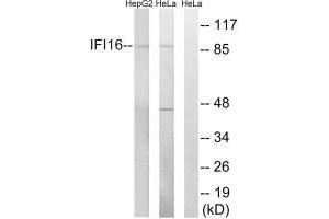Western blot analysis of extracts from HeLa cells and HepG2 cells, using IFI16 antibody. (IFI16 抗体)