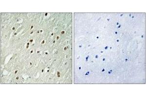 Immunohistochemistry analysis of paraffin-embedded human brain, using CNTROB Antibody. (CNTROB 抗体  (AA 591-640))