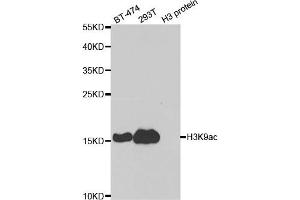 Western blot analysis of extracts of various cell lines and H3 protein expressed in E.