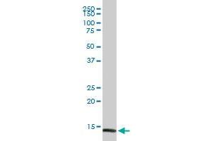 FABP4 MaxPab rabbit polyclonal antibody. (FABP4 抗体  (AA 1-132))