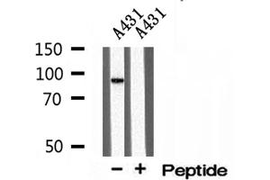 Western blot analysis of extracts of A431 cells, using TELO2 antibody. (TELO2 抗体  (Internal Region))