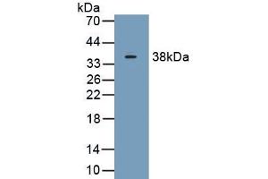 Detection of Recombinant C1qB, Human using Polyclonal Antibody to Complement Component 1, Q Subcomponent B (C1qB) (C1QB 抗体  (AA 28-253))