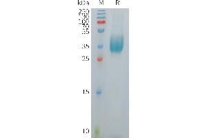 Human V Protein, His Tag on SDS-PAGE under reducing condition.