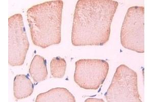 Immunohistochemistry (IHC) image for anti-Nitric Oxide Synthase Trafficker (NOSTRIN) (AA 1-245) antibody (ABIN7432256)