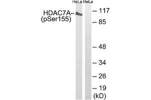 Western blot analysis of extracts from HeLa cells using HDAC7A (Phospho-Ser155) Antibody. (HDAC7 抗体  (pSer155))