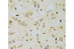 Immunohistochemistry of paraffin-embedded Rat brain using SRP19 Polyclonal Antibody at dilution of 1:100 (40x lens). (SRP19 抗体)