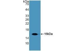 Detection of Recombinant Slit2, Human using Polyclonal Antibody to Slit Homolog 2 (Slit2) (SLIT2 抗体  (AA 1416-1528))