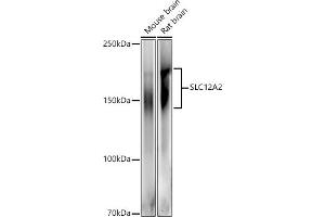 Western blot analysis of extracts of various cell lines, using SLC12 antibody (ABIN6131136, ABIN6147843, ABIN6147844 and ABIN6215366) at 1:500 dilution. (SLC12A2 抗体  (AA 120-280))