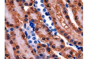 DAB staining on IHC-P; Samples: Rat Kidney Tissue (Glutathione Synthetase 抗体  (AA 270-474))