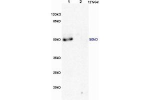 L1 human colon carcinoma lysates L2 rat brain lysates probed with Anti MSR1/CD204 Polyclonal Antibody, Unconjugated (ABIN872905) at 1:200 overnight at 4 °C. (Macrophage Scavenger Receptor 1 抗体  (AA 211-320))