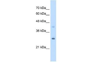 CACYBP antibody used at 5 ug/ml to detect target protein. (CACYBP 抗体  (Middle Region))