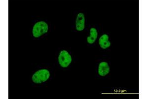Immunofluorescence of purified MaxPab antibody to FLJ12529 on HeLa cell. (CPSF7 抗体  (AA 1-471))