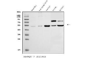 Western blot analysis of SLC14A1/UTE using anti-SLC14A1/UTE antibody (ABIN7602838).