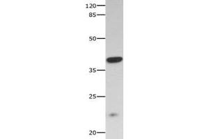 Gel: 10 % SDS-PAGE Lysate: 40 μg Mouse skeletal muscle tissue lysate Primary antibody: 1/300 dilution Secondary antibody: Goat anti Rabbit IgG - H&L (HRP) at 1/10000 dilution Exposure time: 60 seconds (CNTF Receptor alpha 抗体  (AA 23-342))