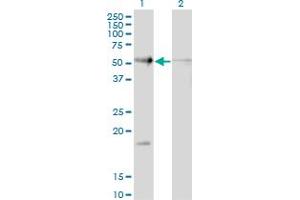 Western Blot analysis of RAD23B expression in transfected 293T cell line by RAD23B monoclonal antibody (M10), clone 3H7. (RAD23B 抗体  (AA 311-409))