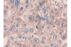 Detection of PAH in Human Liver Tissue using Polyclonal Antibody to Phenylalanine Hydroxylase (PAH) (Phenylalanine Hydroxylase 抗体  (AA 228-452))