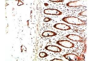 Immunohistochemistry (IHC) image for anti-Chromobox Homolog 5 (CBX5) antibody (ABIN7178392)