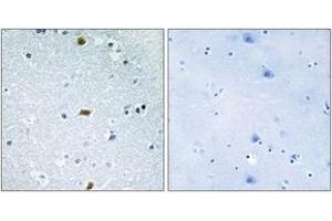 Immunohistochemistry analysis of paraffin-embedded human brain tissue, using ZFHX3 Antibody. (ZFHX3 抗体  (AA 761-810))