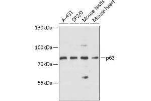 Western blot analysis of extracts of various cell lines, using p63 antibody (ABIN6133471, ABIN6149424, ABIN6149427 and ABIN6216755) at 1:3000 dilution. (p63 抗体  (AA 1-160))