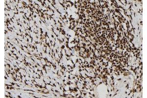 ABIN6277792 at 1/100 staining Human gastric tissue by IHC-P. (Calretinin 抗体  (C-Term))