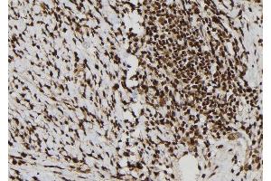 ABIN6277792 at 1/100 staining Human gastric tissue by IHC-P.
