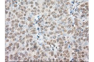 Immunohistochemical staining of paraffin-embedded Human colon tissue using anti-PDE4A mouse monoclonal antibody. (PDE4A 抗体)