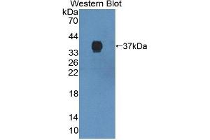 Detection of Recombinant ABCG2, Mouse using Polyclonal Antibody to ATP Binding Cassette Transporter G2 (ABCG2) (ABCG2 抗体  (AA 63-349))