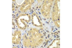Immunohistochemistry of paraffin-embedded human kidney using CIAO1 antibody (ABIN5975509) at dilution of 1/100 (40x lens). (CIAO1 抗体)