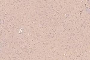 Immunohistochemistry (Paraffin-embedded Sections) (IHC (p)) image for anti-Kinesin Family Member 5B (KIF5B) antibody (ABIN7074440)