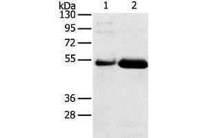 Western Blot analysis of Human placenta and stomach cancer tissue using SAMD3 Polyclonal Antibody at dilution of 1:400 (SAMD3 抗体)