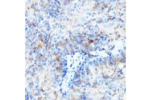 Immunohistochemistry of paraffin-embedded mouse spleen using ULBP1 Rabbit pAb (ABIN6128898, ABIN6149917, ABIN6149918 and ABIN6214755) at dilution of 1:500 (40x lens). (ULBP1 抗体  (AA 26-216))