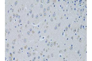 Immunohistochemistry of paraffin-embedded mouse brain using FDFT1 antibody (ABIN5973667) at dilution of 1/100 (40x lens). (FDFT1 抗体)