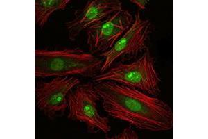 Immunofluorescence (IF) image for anti-cAMP Responsive Element Binding Protein 1 (CREB1) antibody (ABIN969061)