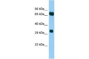 Host:  Rabbit  Target Name:  Melk  Sample Type:  Mouse Testis lysates  Antibody Dilution:  1. (MELK 抗体  (N-Term))