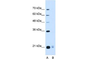 WB Suggested Anti-PLAC1L Antibody Titration:  0. (PLAC1L 抗体  (Middle Region))