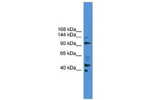 WB Suggested Anti-PIBF1  Antibody Titration: 0. (PIBF1 抗体  (C-Term))