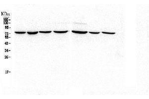 Western blot analysis of HSPA2 using anti-HSPA2 antibody (ABIN5692870).