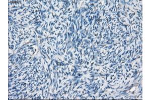 Immunohistochemical staining of paraffin-embedded Ovary tissue using anti-BCKDK mouse monoclonal antibody. (BCKDK 抗体)