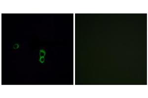 Immunofluorescence analysis of MCF-7 cells, using OR9Q1 antibody. (OR9Q1 抗体  (C-Term))