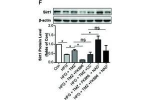 Western Blotting (WB) image for anti-Sirtuin 1 (SIRT1) (AA 448-747) antibody (ABIN6147784)