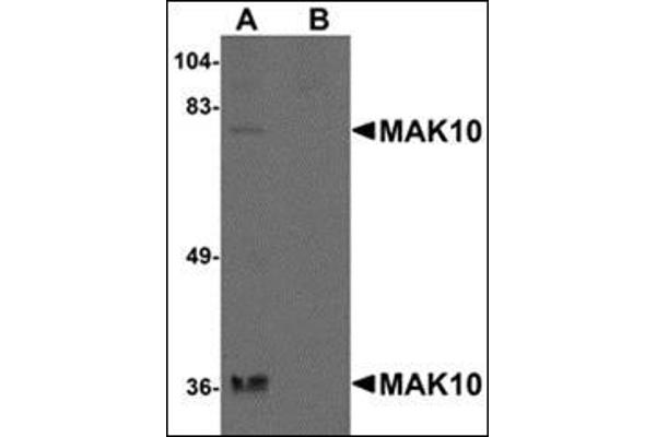 MAK10/NAA35 抗体  (N-Term)