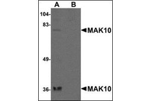 Western blot analysis of MAK10 in rat heart tissue lysate with this product at 1 μg/ml in the (A) absence and (B) presence of blocking peptide.