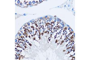 Immunohistochemistry (IHC) image for anti-Y Box Binding Protein 1 (YBX1) (AA 100-200) antibody (ABIN6150328)