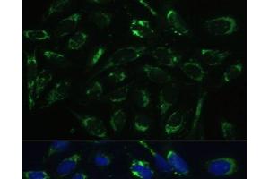Immunofluorescence analysis of U-2 OS cells using HSD17B10 Polyclonal Antibody at dilution of 1:100 (40x lens). (HSD17B10 抗体)