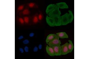 ABIN6255330 and ABIN6277725 staining Hela cells(30 min of UV treatment) by IF/ICC.