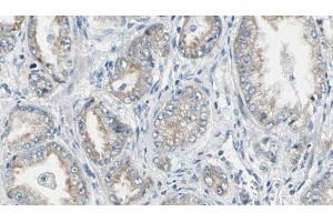 ABIN6276723 at 1/100 staining Human prostate tissue by IHC-P. (NAT1 抗体  (Internal Region))