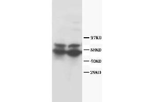 Anti-RUNX2 antibody, Western blotting Lane 1: Rat Thymus Tissue Lysate Lane 2: Rat Testis Tissue Lysate (RUNX2 抗体  (Middle Region))