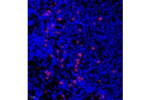 Immunofluorescence (Paraffin-embedded Sections) (IF (p)) image for anti-CD177 Molecule (CD177) antibody (ABIN7073372)